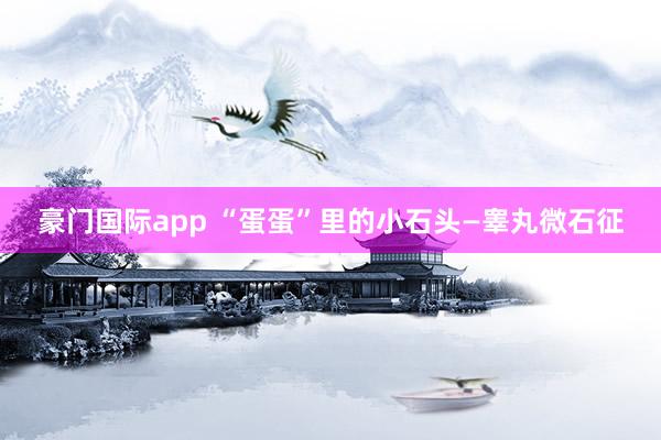豪门国际app “蛋蛋”里的小石头—睾丸微石征